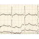 Medwelt CM 1200 B 12 Kanal Yorumlu Ekg Cihazı