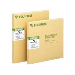 Röntgen Filmi Fujifilm 35x43 Yeşile Hassas